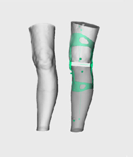 brace-type1-1