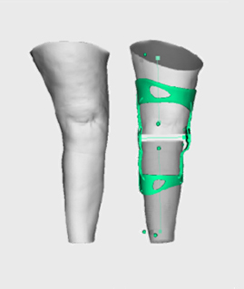 brace-type2-1